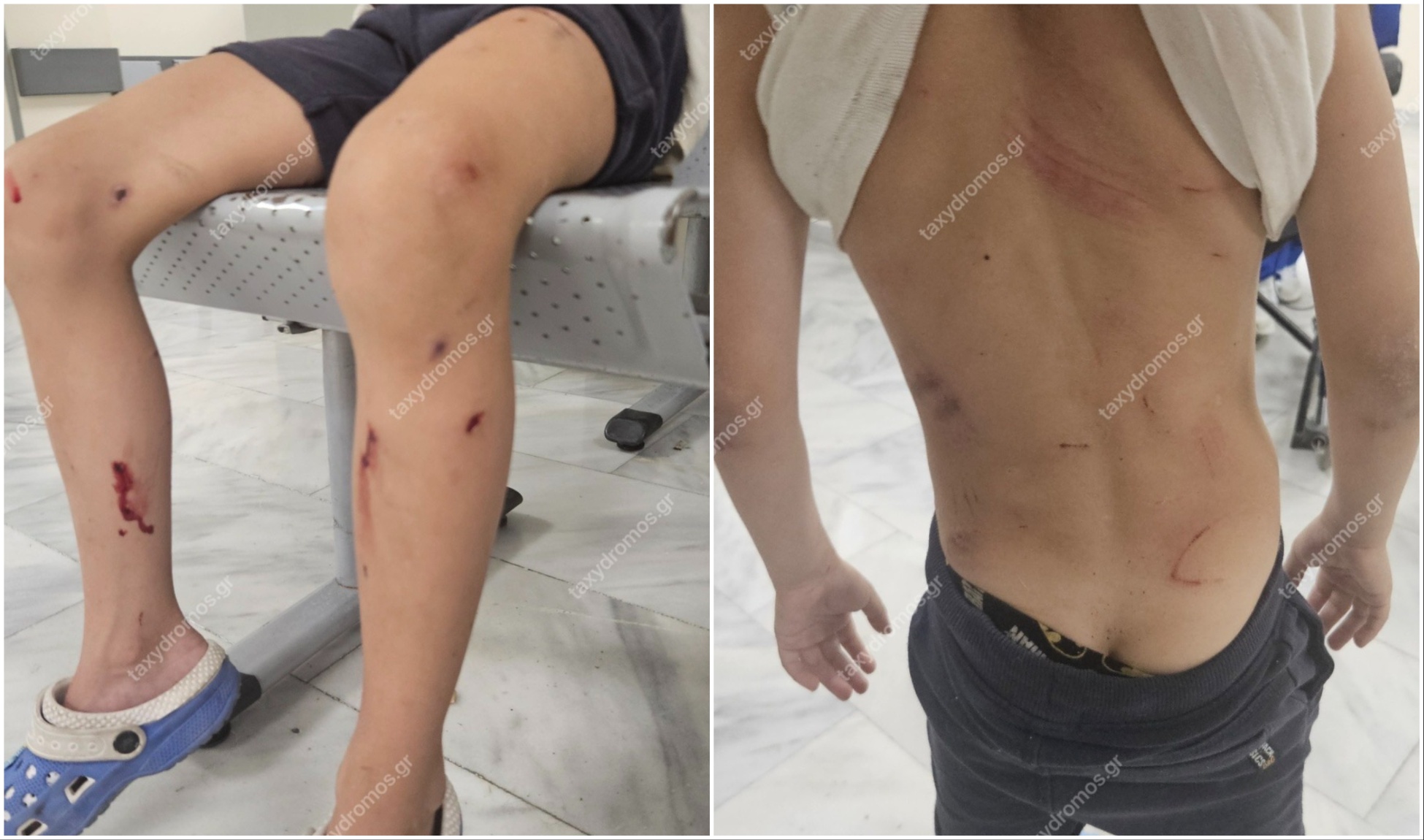 Σοκ στον Βόλο: Αδέσποτα κατασπάραξαν 7χρονο παιδί στην Αγ. Παρασκευή Σοκ στον Βόλο: Αδέσποτα κατασπάραξαν 7χρονο παιδί στην Αγ. Παρασκευή