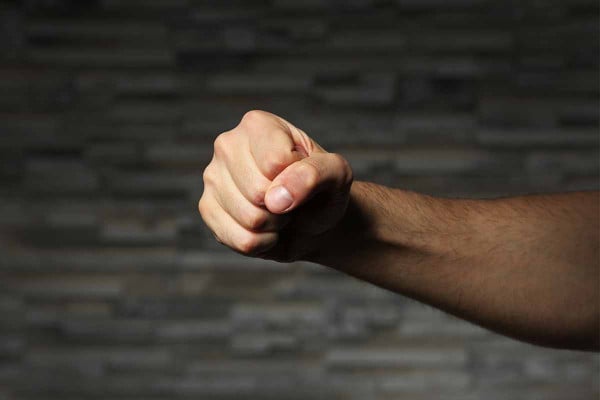 Ιδιοκτήτης Bar στον Βόλο ξυλοκόπησε 21χρονο φοιτητή που δουλεύει υποδοχή σε κλαμπ Ιδιοκτήτης Bar στον Βόλο ξυλοκόπησε 21χρονο φοιτητή που δουλεύει υποδοχή σε κλαμπ