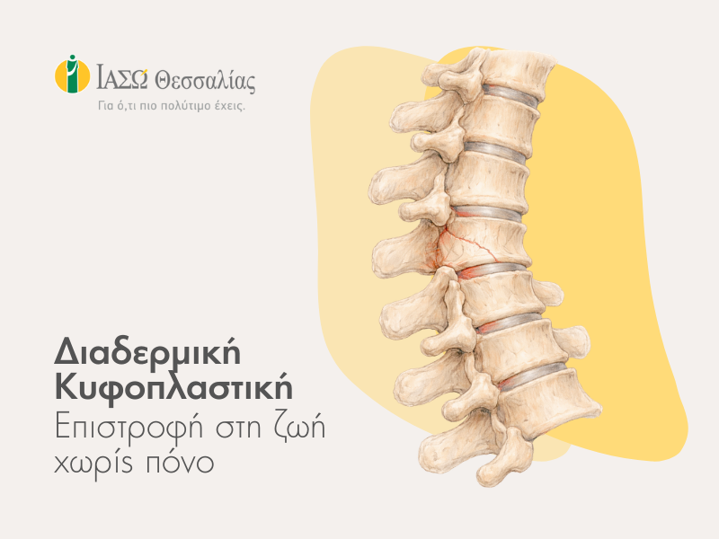 ΙΑΣΩ Θεσσαλίας: ΔΙΑΔΕΡΜΙΚΗ ΚΥΦΟΠΛΑΣΤΙΚΗ-  Λύση χωρίς ανοικτό   χειρουργείο για το κάταγμα σπονδύλου (φωτο)