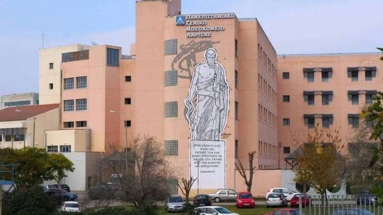 Στο Πανεπιστημιακό Νοσοκομείο Λάρισας 12χρονη από Αλόννησο όταν «έσκασε» καπάκι χύτρας!