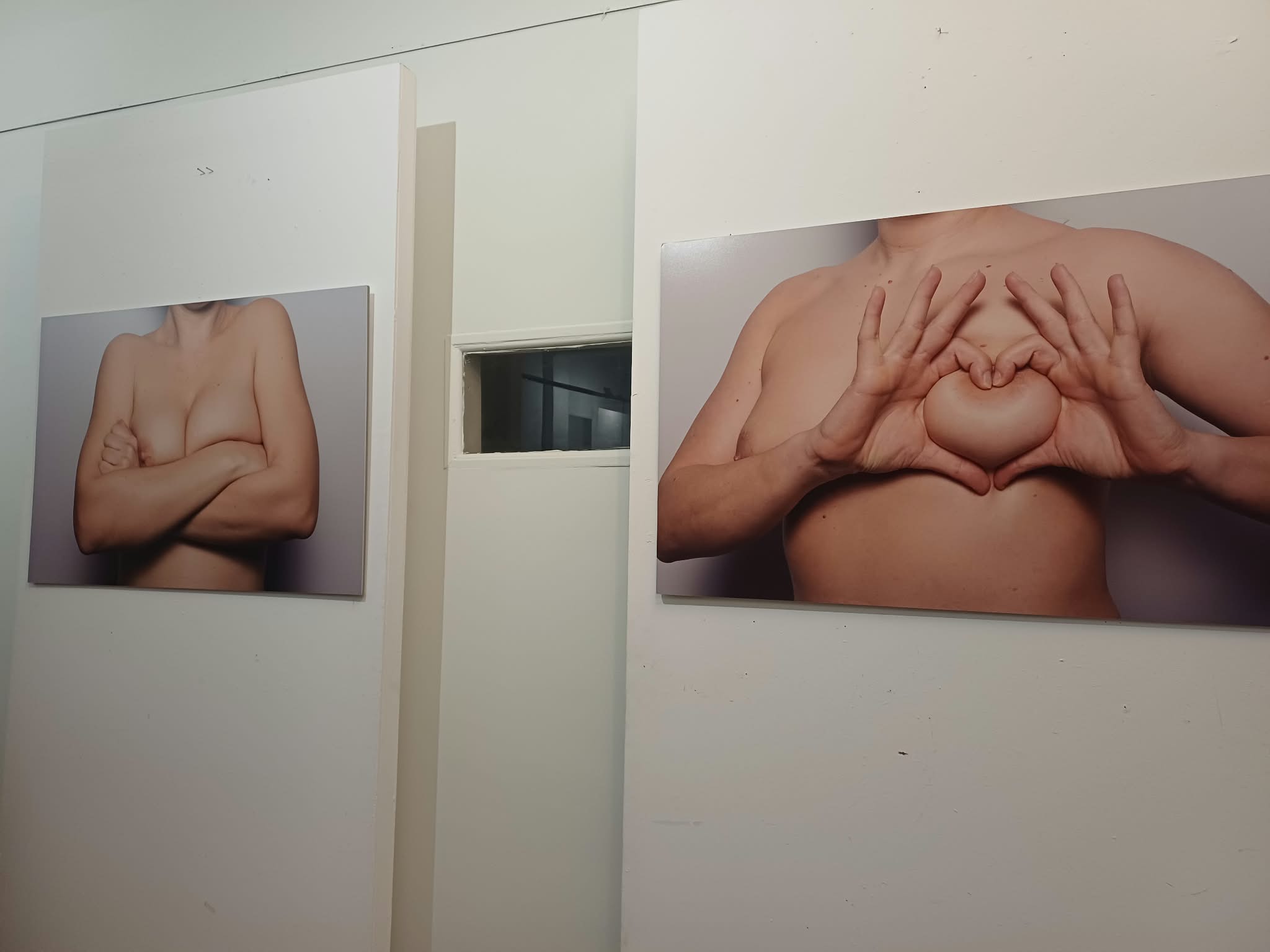 «boobs – art for awareness» στη Λάρισα: Όταν η τέχνη μιλά ανοιχτά για το σώμα και τον καρκίνο του μαστού (ΦΩΤΟ)