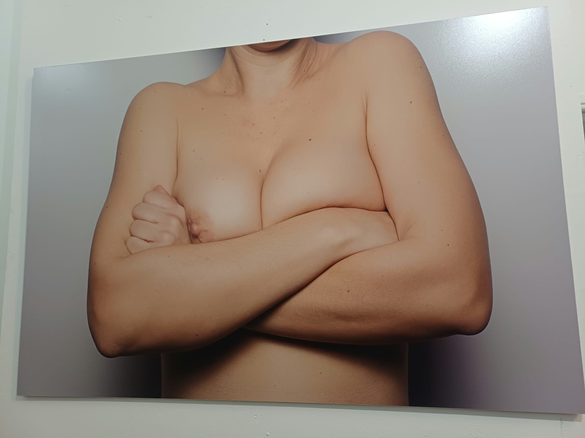 «boobs – art for awareness» στη Λάρισα: Όταν η τέχνη μιλά ανοιχτά για το σώμα και τον καρκίνο του μαστού (ΦΩΤΟ)