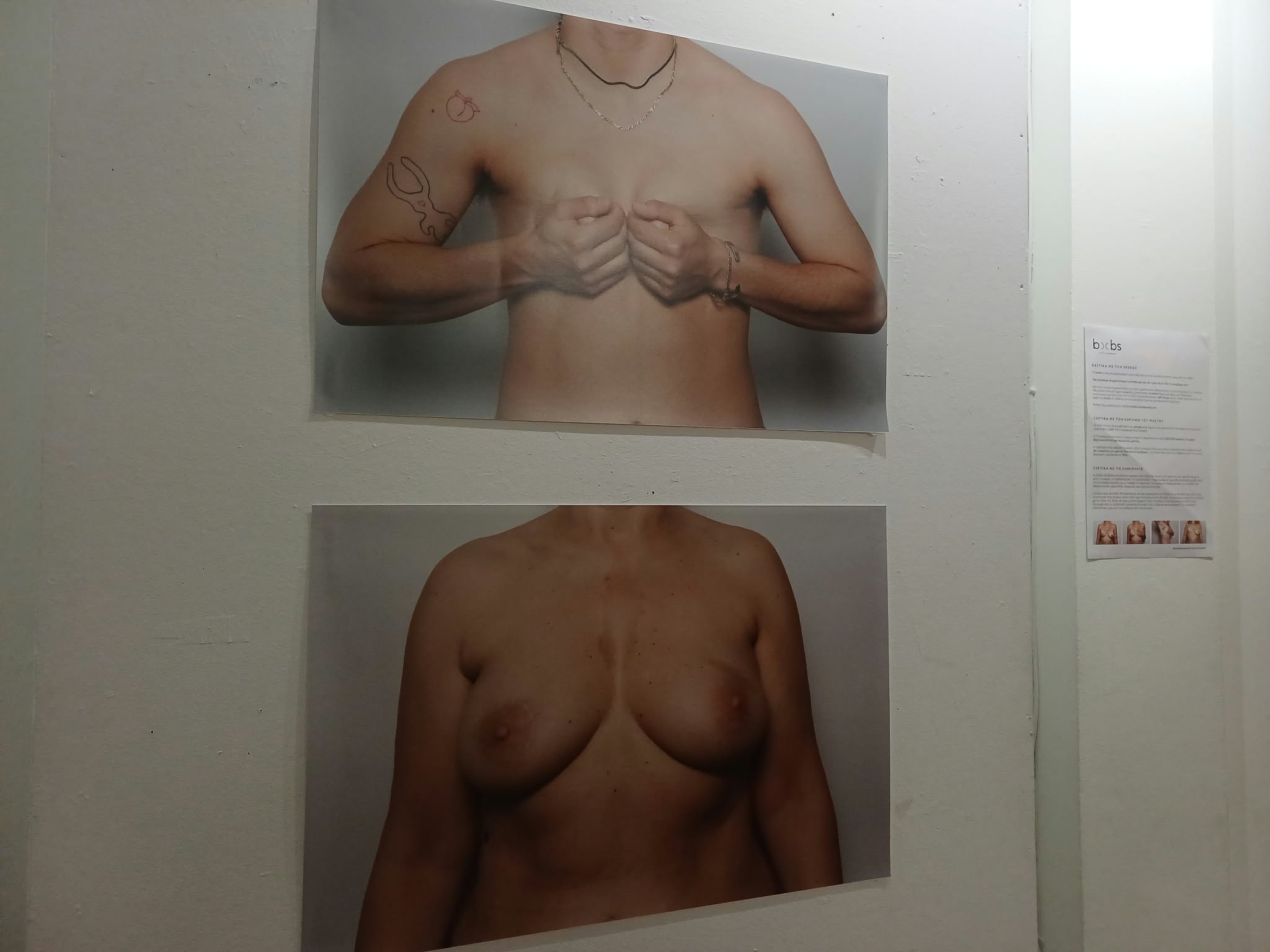 «boobs – art for awareness» στη Λάρισα: Όταν η τέχνη μιλά ανοιχτά για το σώμα και τον καρκίνο του μαστού (ΦΩΤΟ)